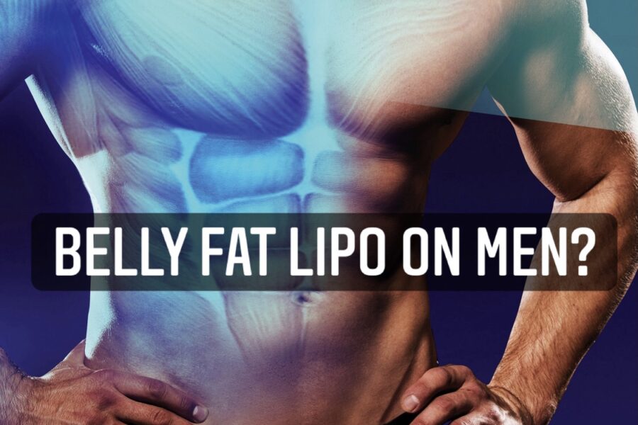 Belly Fat Lipo on Men