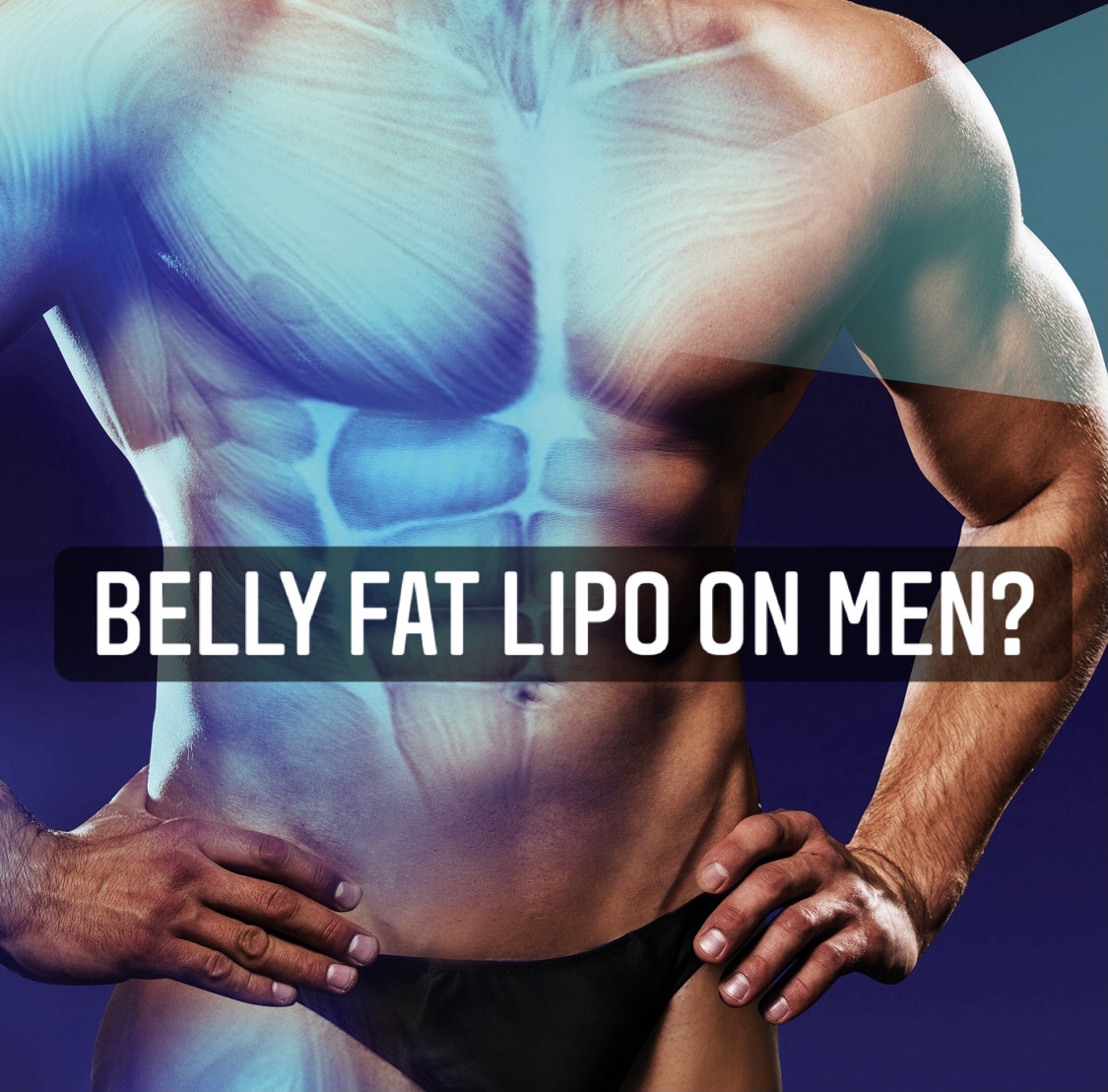 Belly Fat Lipo on Men?