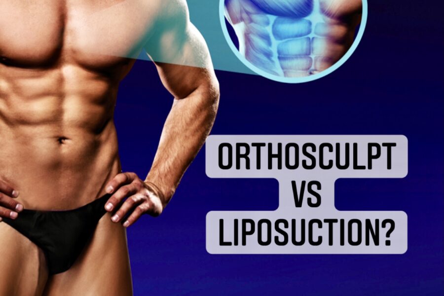 OrthoSculpt vs. Liposuction