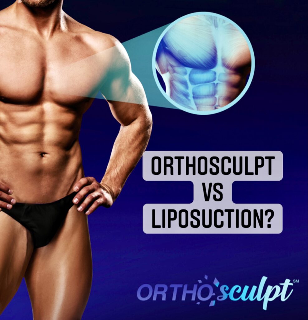 OrthoSculpt vs. Liposuction