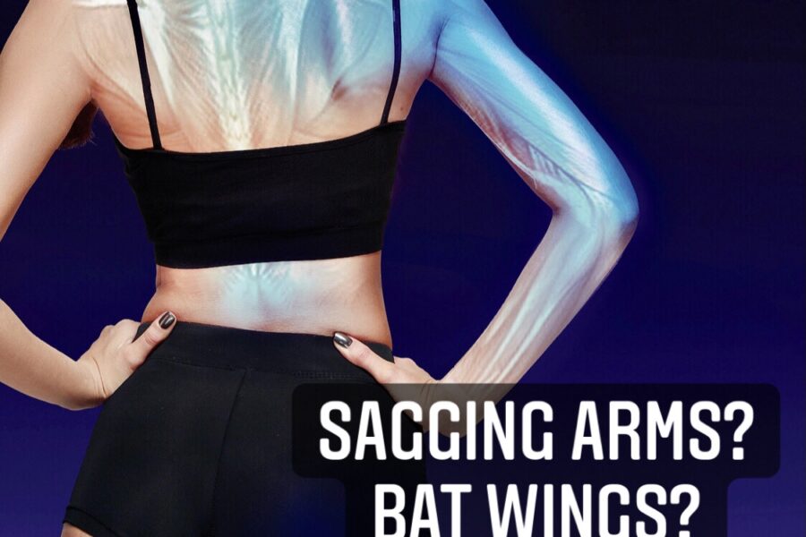 Sagging Arms