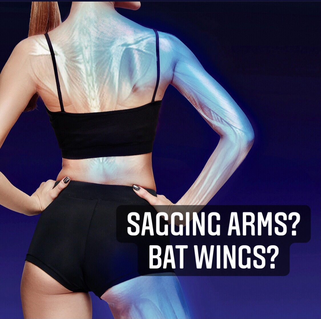 Sagging Arms? Bat Wings?