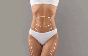 Revolutionizing Body Contouring: Discover Lipo 360 Near You