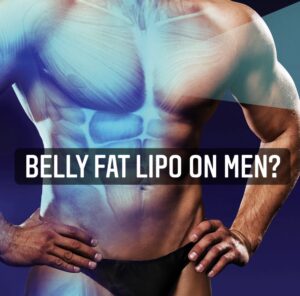 Belly Fat Lipo on Men