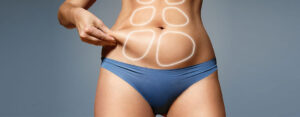 fat removal surgery