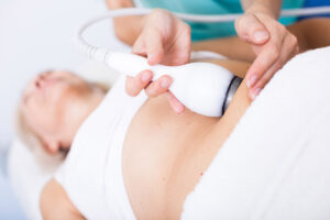 Laser Fat Removal: Your Guide to a Slimmer, Healthier You
